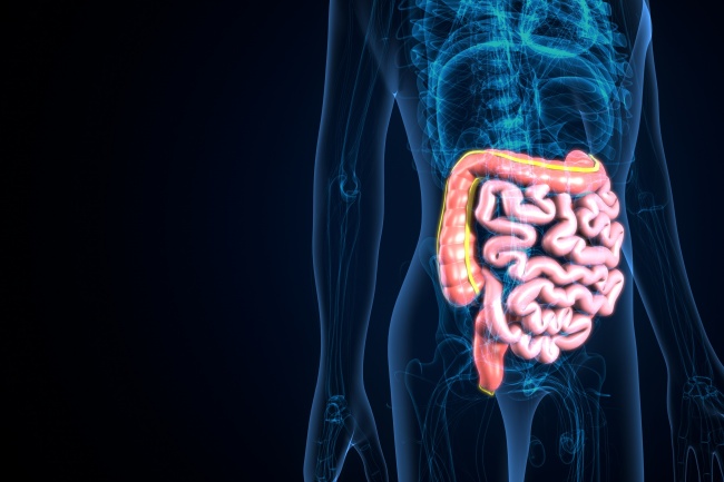 Leaky gut: quando a permeabilidade do intestino se torna um problema!